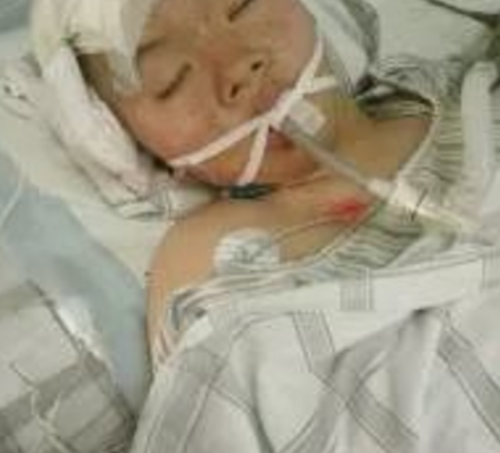 泉州17岁少女大年初二遇车祸 至今未醒