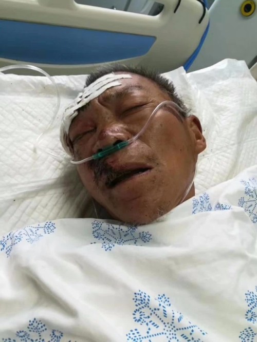 扩散！滑县老人遭遇车祸生命垂危 急寻家人