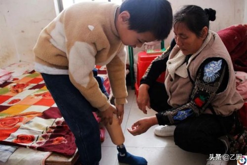 孙子孙女同时患病，刚带一个入院治疗又遭车祸截肢，奶奶放声痛哭