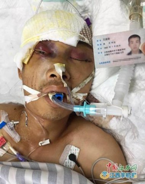 王超荣生前在医院接受治疗王超荣生前与战友的合影(图中二排左一是王